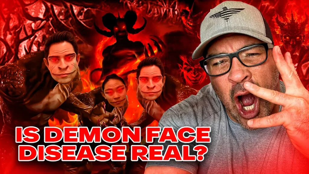 David Nino Rodriguez talks about demon face syndrome