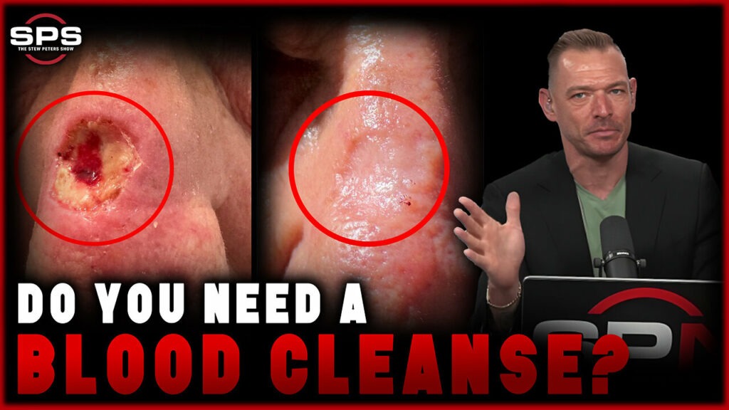 Stew Peters Network talks about if you can cleanse your blood