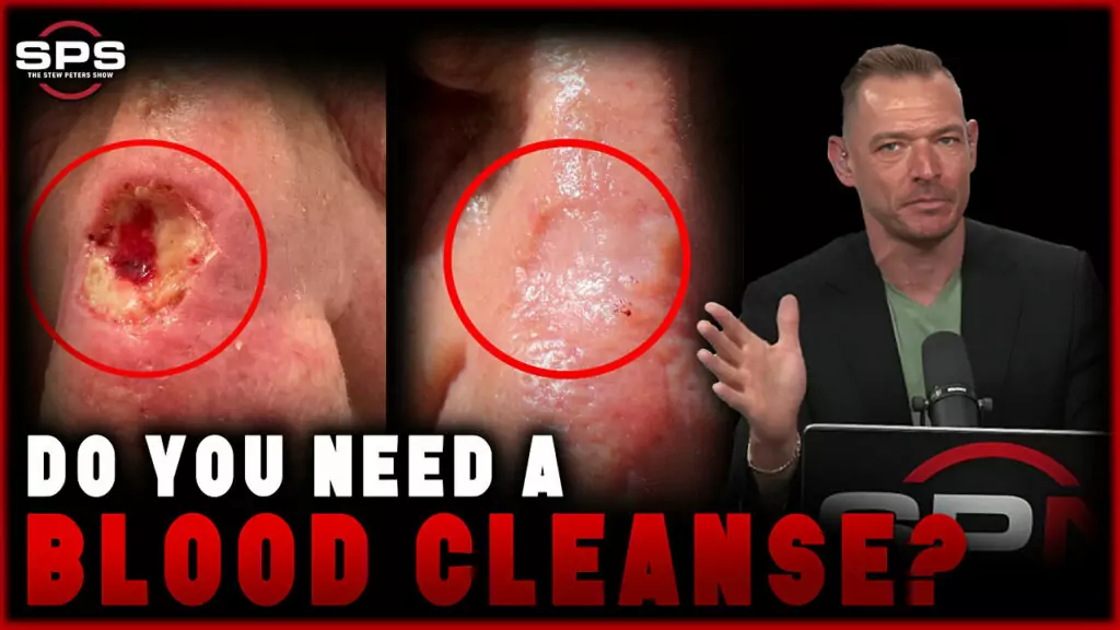 Stew Peters Network talks about if you can cleanse your blood