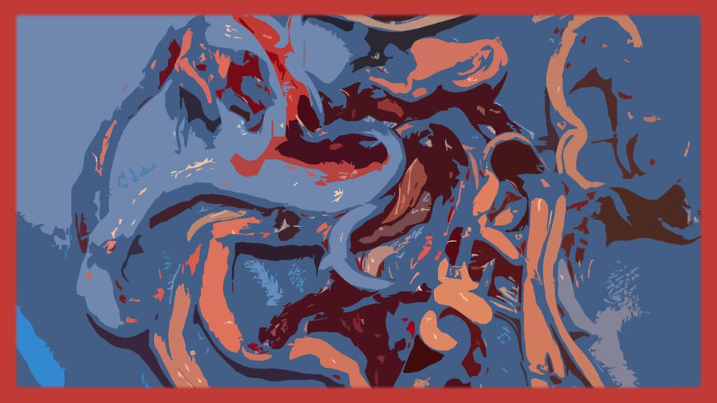 Greg Reese talks about 70 of tennesse embalmers still seeing death by clot shot