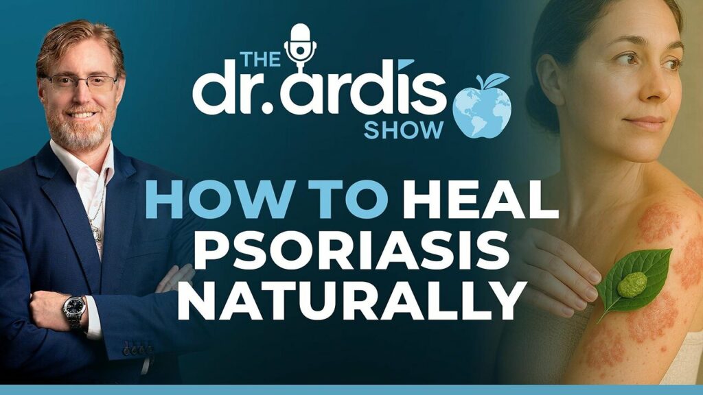 Dr. Bryan Ardis talks about a show to heal psoriasis naturally