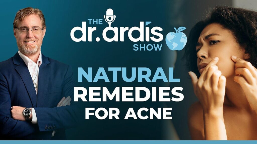 Dr. Bryan Ardis talks about natural remedies for acne